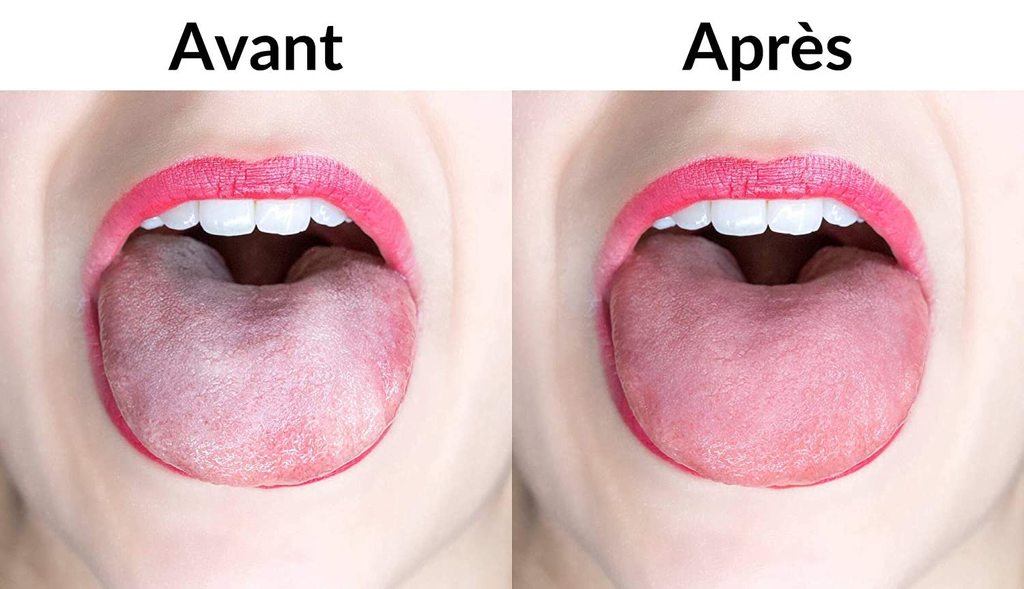 Efficacite gratte langue