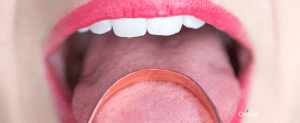 bouche gratte langue